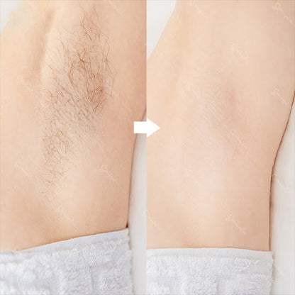 Hair Removal Oil